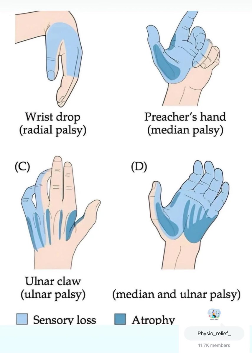 Hand signs