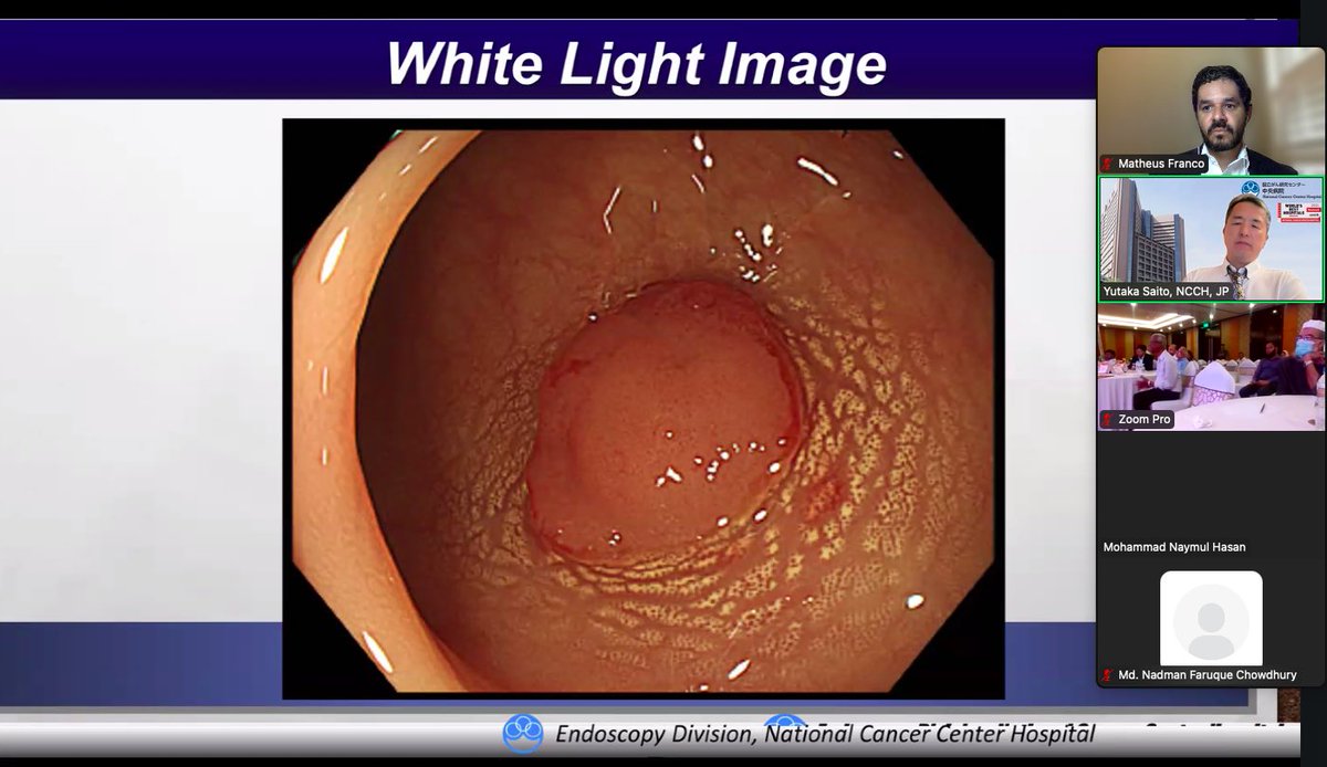 MatheusFrancoMD's tweet image. Honored to virtually join the SPACE Endoscopy Master-Class 2025 in Bangladesh 🇧🇩 — a high-level event featuring the distinguished Prof. Yutaka Saito and brilliant discussions on EMR & ESD. Grateful for the opportunity! #Endoscopy #ESD #EMR #GlobalGI