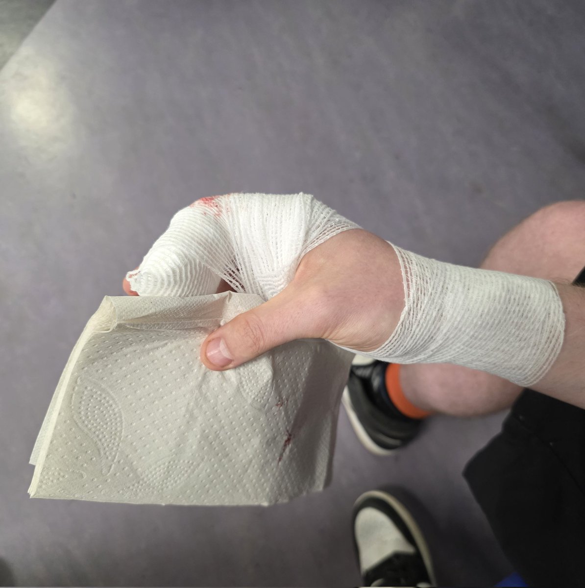 TigressX π EGX (@tigress_x) on Twitter photo So.... livestream is not looking likely today π³
I've been at A&E with <a href="/iRaffer/">iRaffer</a> for hours coz he CUT THE END OF HIS FINGER OFF WITH A MANDOLINE π€£π€£ I HAD TO DRIVE HIM TO THE HOSPITAL WITH A PIECE OF HIS FINGER IN MY POCKET π€¦ββοΈπ€¦ββοΈ
How's your day going? π So.... livestream is not looking likely today π³
I've been at A&E with <a href="/iRaffer/">iRaffer</a> for hours coz he CUT THE END OF HIS FINGER OFF WITH A MANDOLINE π€£π€£ I HAD TO DRIVE HIM TO THE HOSPITAL WITH A PIECE OF HIS FINGER IN MY POCKET π€¦ββοΈπ€¦ββοΈ
How's your day going? π