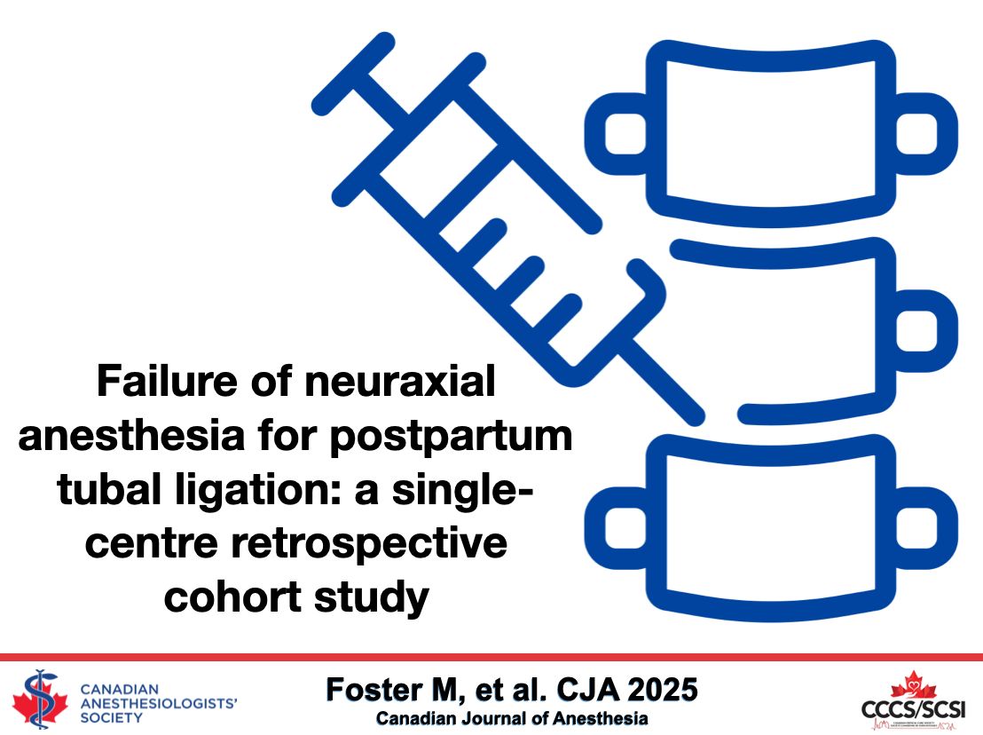 Failure of neuraxial anesthesia for postpartum tubal ligation: a single-centre retrospective cohort study - Canadian Journal of Anesthesia #CJA #CJA2025 #Anesthesia #Anesthesiology buff.ly/yWB25Ch