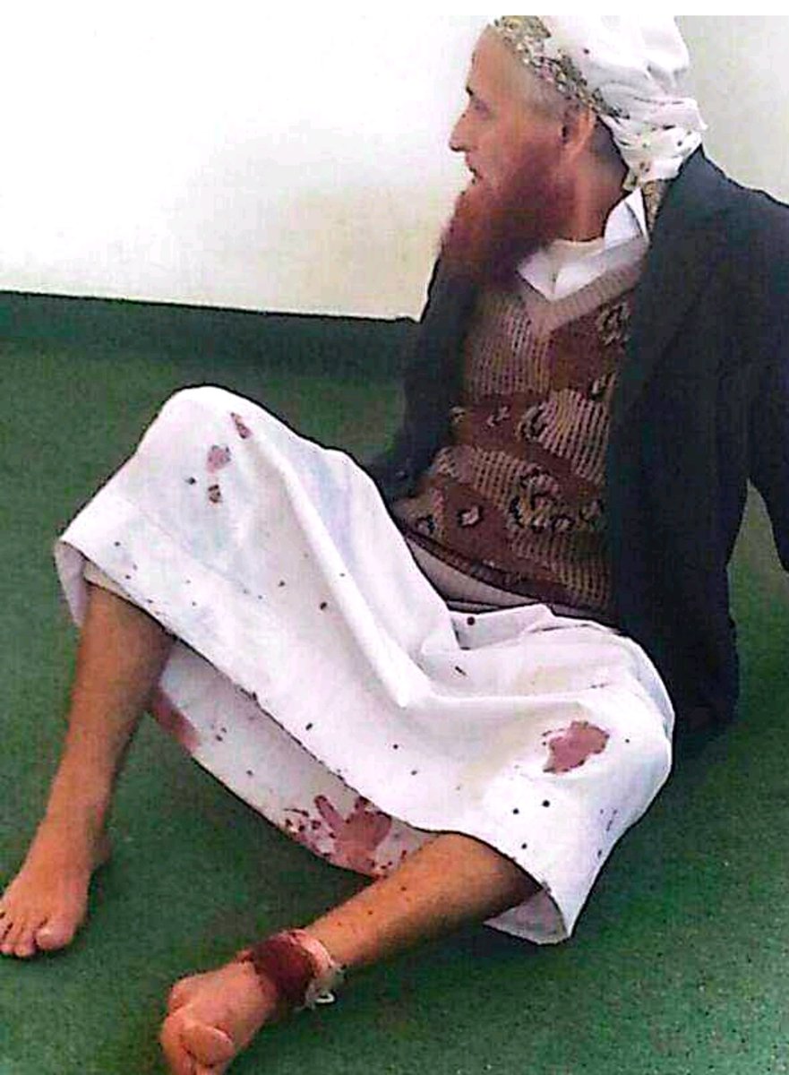 في أبريل 2016 اقتحمت المليشيات الحوثية مسجد التقوى في الحي الغربي بمدينة ذمار وأطلقت النار على إمام وخطيب المسجد الشيخ المسن علي حفظ الله الأهنومي ونجله المعتصم داخل المسجد أمام المصلين قبل إقامة صلاة العشاء، ثم اختطفتهما وهما ينزفان إلى جهة مجهولة #الشيخ_صالح_حنتوس #ذمار #اليمن