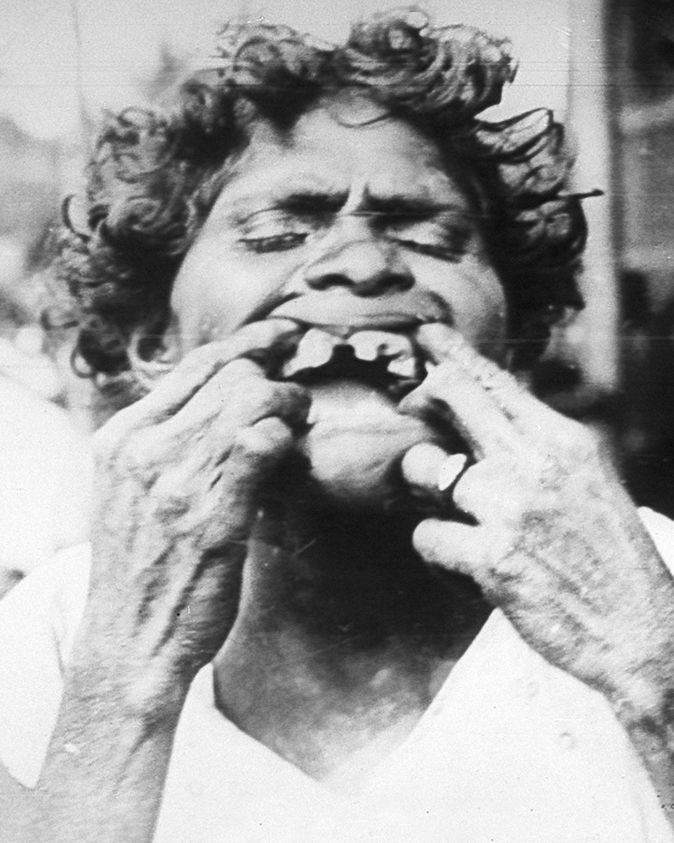 WestonAPrice's tweet image. The teeth tell the tale, folks! Read our article: bit.ly/theteethtellth…
Shared from Price-Pottenger Nutrition Foundation @PricePottenger: Dr. Weston A. Price traveled the world to uncover why ancestral cultures maintained strong, beautiful dental health—free from cavities and…