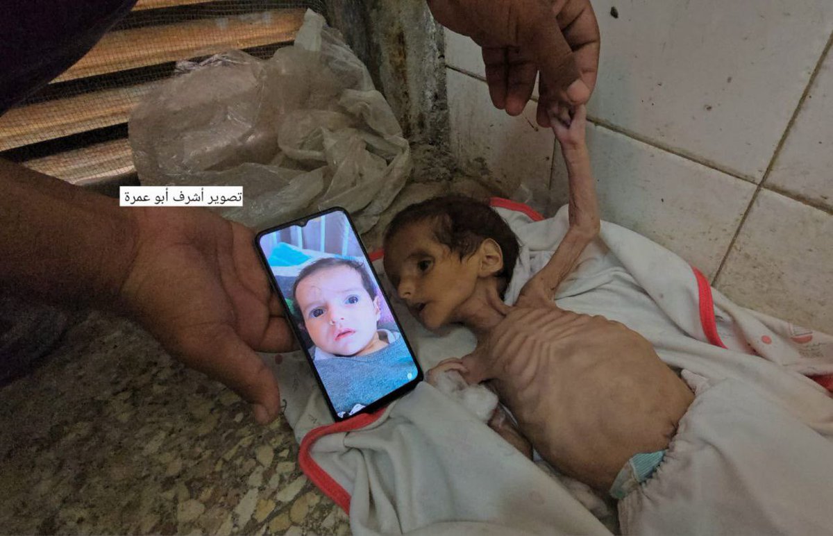 A lot of zionsits seem triggered by this post. So, here's some baby they starved to death, deliberately