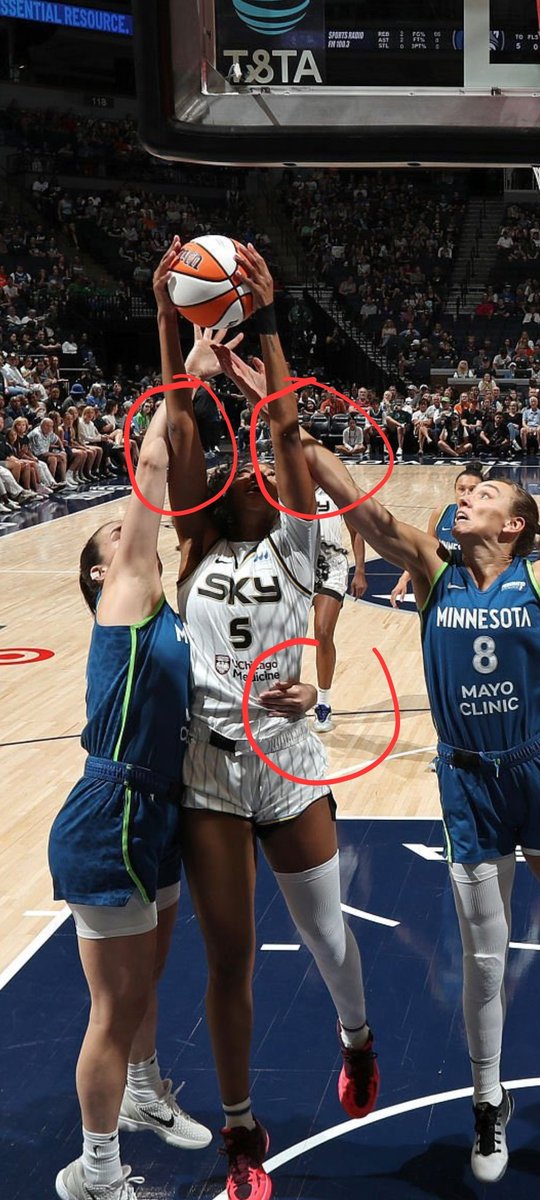 This happens in every game to Angel. The girl has two wrist injuries because of this 🐂💩.