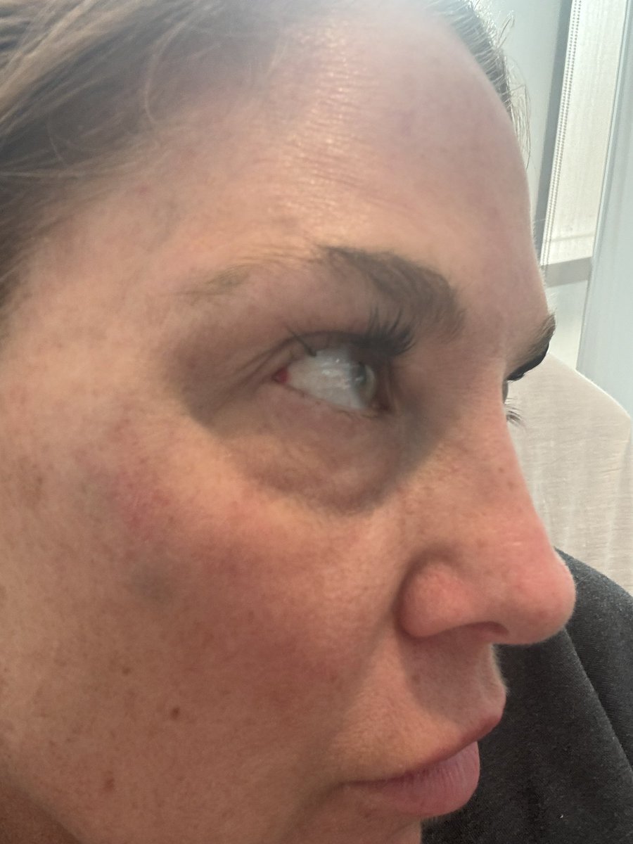 💗 𝕯ᥲᥒіᥴᥲ 𝕷ᥲᥒᥱ 💗 (@lovedanilane) on Twitter photo This is autism. I told my 23yr old, 200lb son, dinner was going to be later than he hoped. This is autism. I told my 23yr old, 200lb son, dinner was going to be later than he hoped.