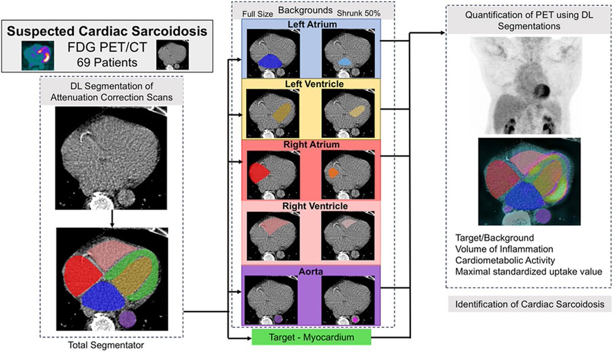 Bruno Lima (@brunolimamdphd) on Twitter photo Fully automated volumetric quantification of FDG PET for cardiac sarcoidosis based on CT attenuation map-derived volumetry is feasible, rapid, and has high prediction performance. <a href="/robertjhmiller/">Robert Miller</a> <a href="/UCalgary/">U Calgary</a> <a href="/Piotr_JSlomka/">Piotr Slomka PhD</a> <a href="/SmidtHeart/">Smidt Heart Institute at Cedars-Sinai</a> <a href="/JNCjournal/">Journal of Nuclear Cardiology</a>
Editorial by Osamu Manabe Jichi Fully automated volumetric quantification of FDG PET for cardiac sarcoidosis based on CT attenuation map-derived volumetry is feasible, rapid, and has high prediction performance. <a href="/robertjhmiller/">Robert Miller</a> <a href="/UCalgary/">U Calgary</a> <a href="/Piotr_JSlomka/">Piotr Slomka PhD</a> <a href="/SmidtHeart/">Smidt Heart Institute at Cedars-Sinai</a> <a href="/JNCjournal/">Journal of Nuclear Cardiology</a>
Editorial by Osamu Manabe Jichi