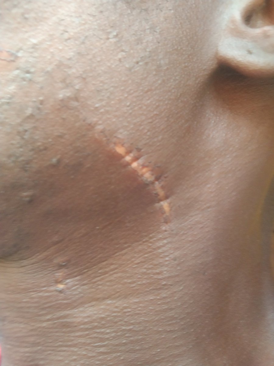 Capture_one's tweet image. #AllIWantIsJustice 
May 23rd 2025 DelaquaSl @staffs beat up production manager Mugboma Agriculture radio station in Blama Small Bo Chiefdom.
We want justice to prevail #Salone4WeAll @FisherAdrian @USEmbFreetown @slajpresident @SLAJ_Salone @HumanRightsCtte @unhrcpr @BBCWorld