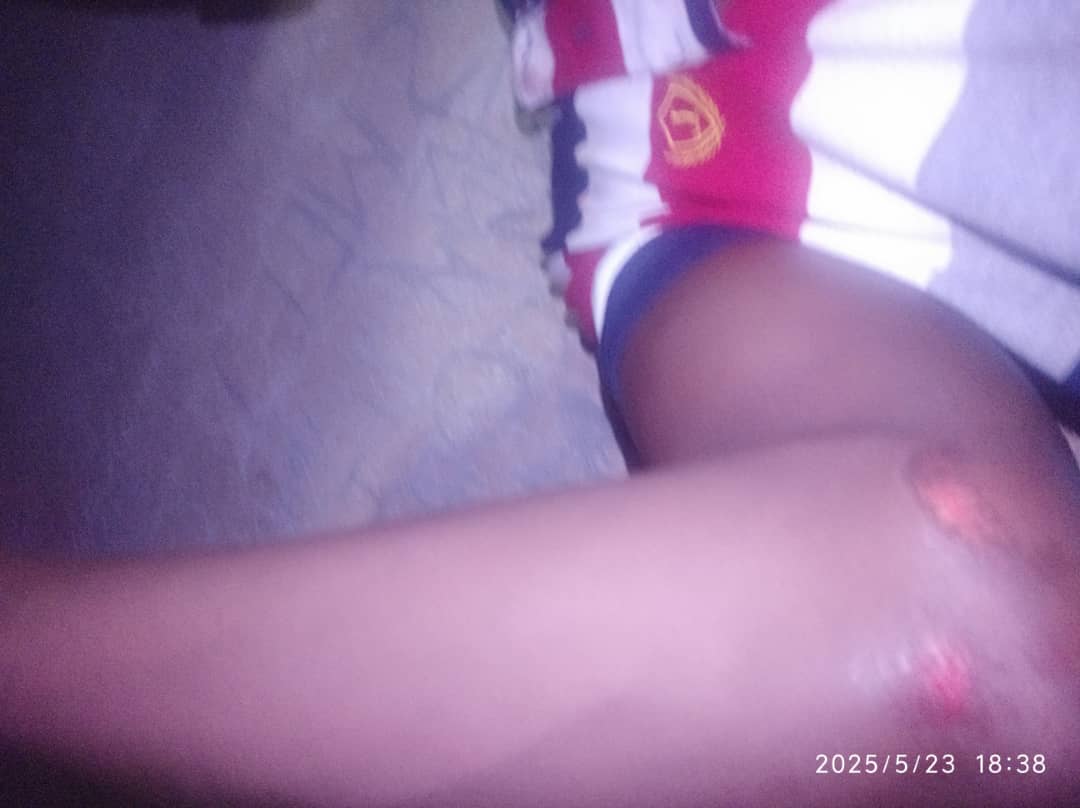 Capture_one's tweet image. #AllIWantIsJustice 
May 23rd 2025 DelaquaSl @staffs beat up production manager Mugboma Agriculture radio station in Blama Small Bo Chiefdom.
We want justice to prevail #Salone4WeAll @FisherAdrian @USEmbFreetown @slajpresident @SLAJ_Salone @HumanRightsCtte @unhrcpr @BBCWorld