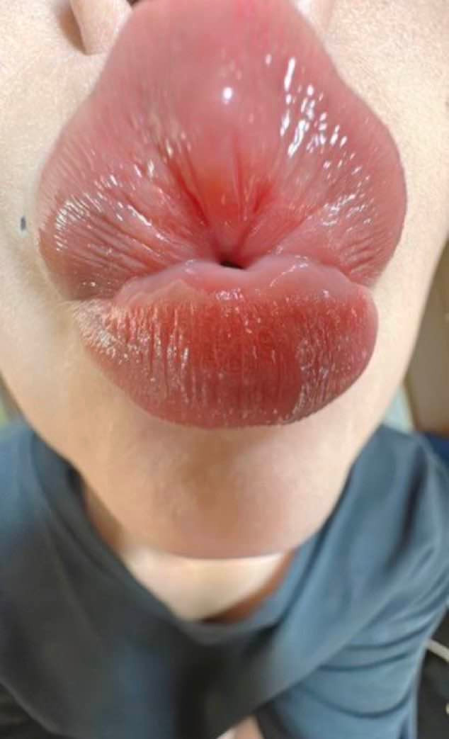 🥚The Eggma'am🥚 tweet media