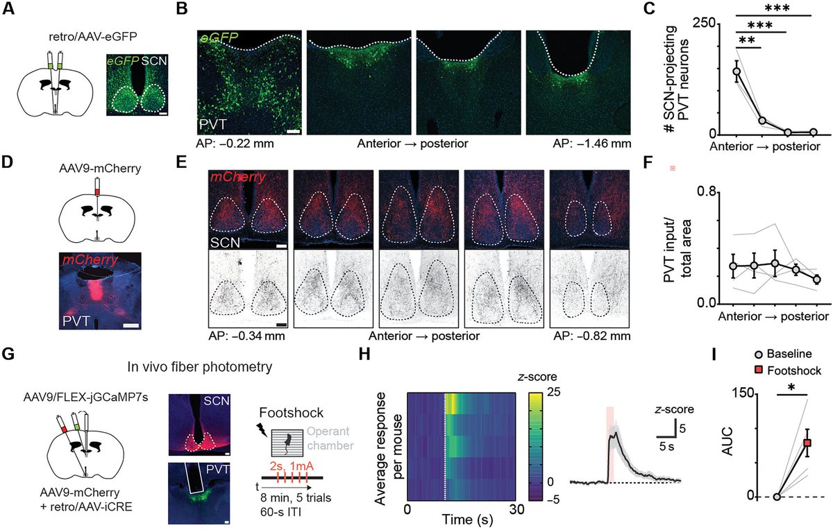 A new study in mice uncovers a stress-sensing circuit that interacts with light to influence circadian outputs. 

The work in <a href="/ScienceAdvances/">Science Advances</a> offers a roadmap for exploring the circuits linking light, circadian/sleep, and stress-related psychiatric disorders.