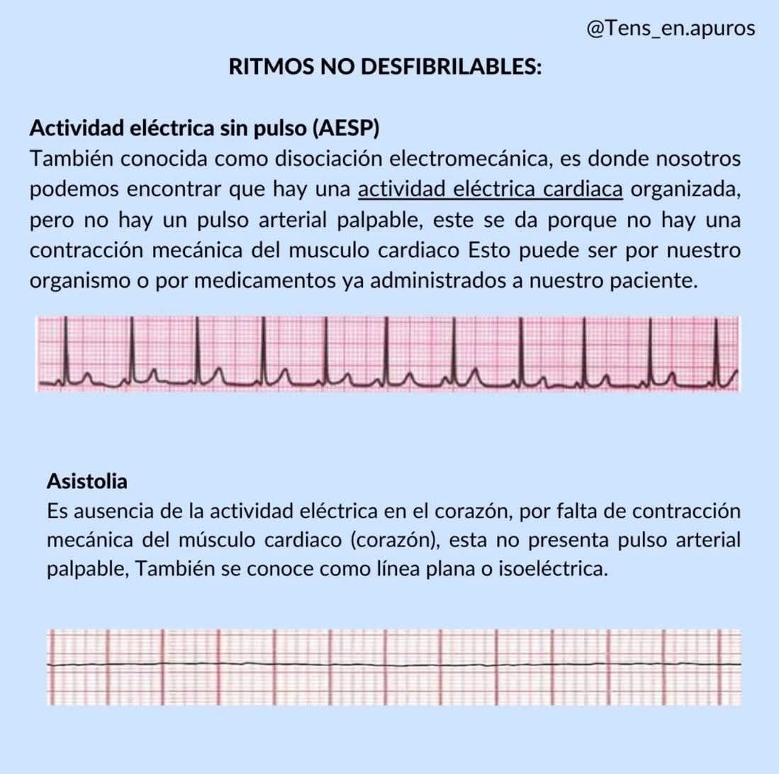 NO desfibrilables