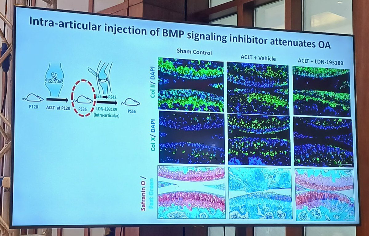 drMsayan's tweet photo. 🌟A stellar session at #SOARCON2025 kolkata

Prof. Amitabha Bandyopadhy @abandopa delivers a powerful talk on the critical role of BMP signaling in osteoarthritis research. 
A masterclass in cutting-edge research! 🔬✨
Science in full flight! 🔬🧠 
#Osteoarthritis #OAresearch https://t.co/LunQS0h9rl