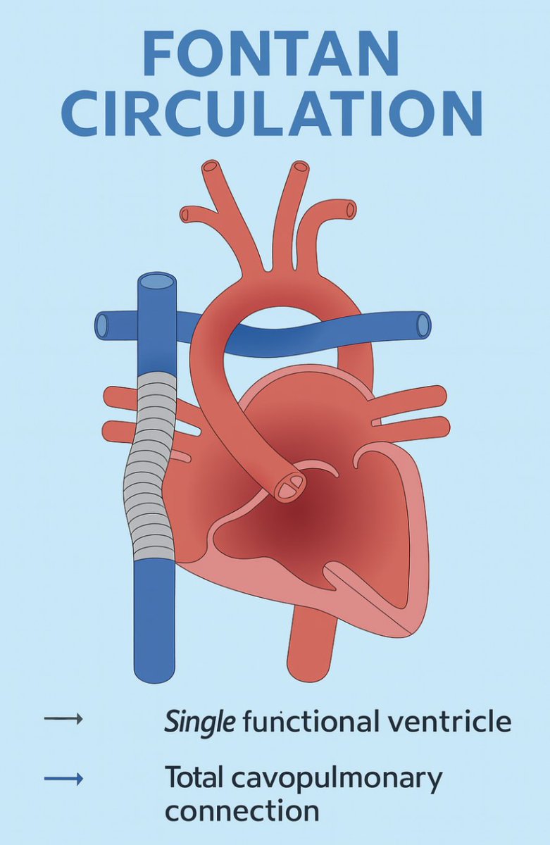 CardioNeo's tweet image. New section now live: Single Ventricle. Covers anatomy, physiology, AV valve types, Fontan pathway, surgical options (Norwood-BTT, Sano, Hybrid), and long-term outcomes. Reflects the evolving landscape of congenital cardiology.
neocardiolab.com/congenital-hea…