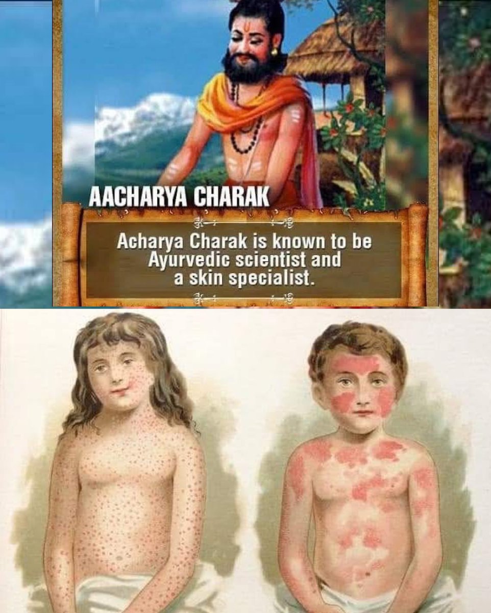 Cambridge university के एक डॉक्टर थे
विलियम अलिवर (William oliver)। अच्छे डक्टर थे क्योंकि सब कुछ लिखकर गये थे....!

चेचक के टीके का पहला सुत्र मिलता है ''महर्षि चरक'' जी के '' चरक संहिता '' में।