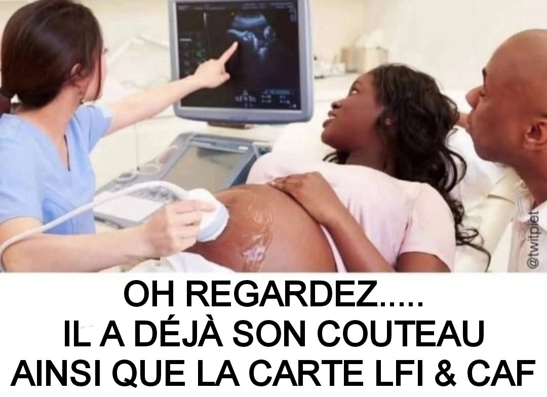 Opticall_'s tweet photo. @DarkanMikael @Henri2Turenne La science est raciste 🤔🤔🤔 https://t.co/7aLnAUeZ0b