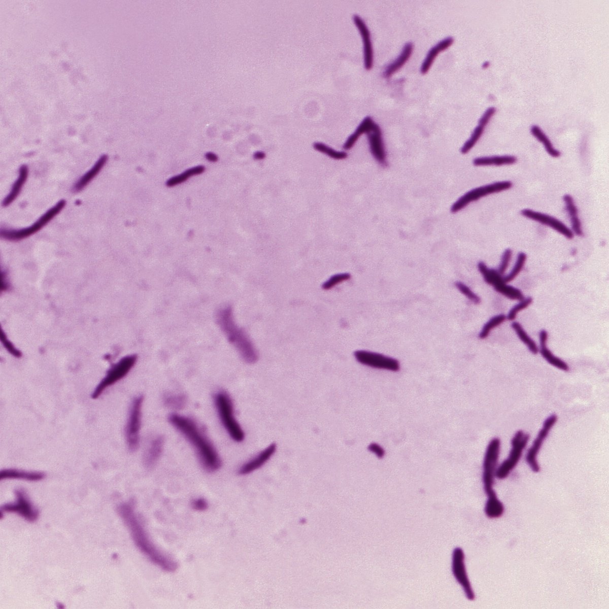 Instituto de Salud Carlos III (ISCIII) tweet media