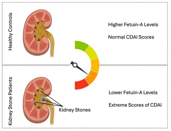JCM_MDPI's tweet photo. #mdpijcm
📢 Happy to share the new #ResearchPaper
🌟Views 867, Citations 3
Low Serum and Urine Fetuin-A Levels and High Composite Dietary Antioxidant Index as Risk Factors for #Kidney_Stone Formation
by Mehmet Arif Icer et al.
🎯https://t.co/2lwO58PlAL
@MediPharma_MDPI https://t.co/mTCAd0uU5l