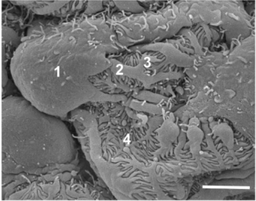 IMNA (@imna_journal) on Twitter photo 👏#LatestPaper 
📷Integrating Traditional Chinese Medicine in the Management of #Podocytopathies
Pathological Insights and #Therapeutic Perspectives
#Podocyte #immune
journals.lww.com/imna/fulltext/… 👏#LatestPaper 
📷Integrating Traditional Chinese Medicine in the Management of #Podocytopathies
Pathological Insights and #Therapeutic Perspectives
#Podocyte #immune
journals.lww.com/imna/fulltext/…
