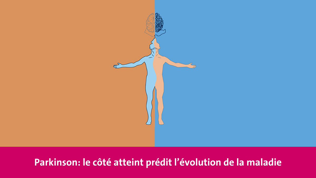 UNIGEnews's tweet image. Une équipe de l’UNIGE et des HUG montre que le côté d’apparition des premiers symptômes de Parkinson — à gauche ou à droite du corps — prédit l'évolution de la maladie. @hug_ge #UNIGE #Parkinson
ow.ly/MeXf50WlsNE