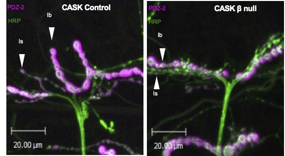 9 months postdoc will be to continue our labs work development Drosophila models of CASK function and disease funded by CASK research. 
search for the job ACAD108170 for Bristol University Job HR website