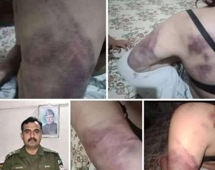 اوکاڑہ پولیس کے SHO سے شادی نہ کرنا لڑکی کو مہنگا پڑ گیا رات بھر تھانہ کی رہائش گاہ پر شراب پی کر برہنہ کر کے رسے سے باندھ کر الٹا لٹکا کر تشدد کا نشانہ بناتا رہا اور ( ص ) نامی لڑکی کے منہ پر زبردستی ولایتی شراب بھی چھڑکتا رہا لڑکی کے بازوؤں پر دانتوں سے جگہ جگہ کاٹتا رہا لڑکی