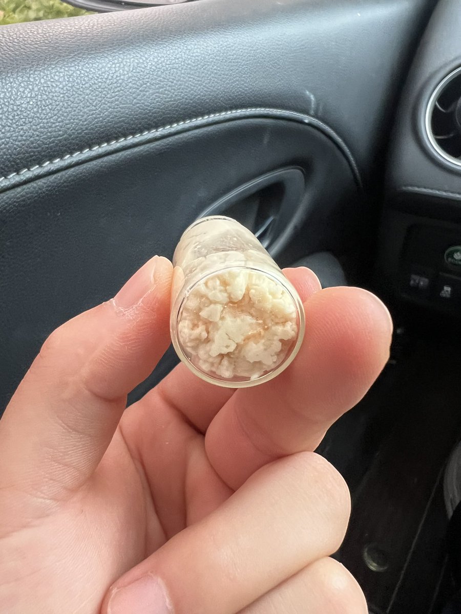 两个月的量，打包发货，这个包皮垢你馋不馋，攒的最多的一次，大满贯包皮垢垢瓶，骚逼儿子够享受的了