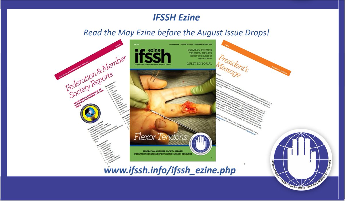 IFSSHand's tweet image. Stay in the loop with the May 2025 Ezine. Browse through this issue before the next one arrives in August! 🌍📰 Find out what's new in hand surgery at ifssh.info/ifssh_ezine.php.🤚🌎✋ #HandSurgery #WeAreIFSSH @apfsshand @ifsht_hand_therapy