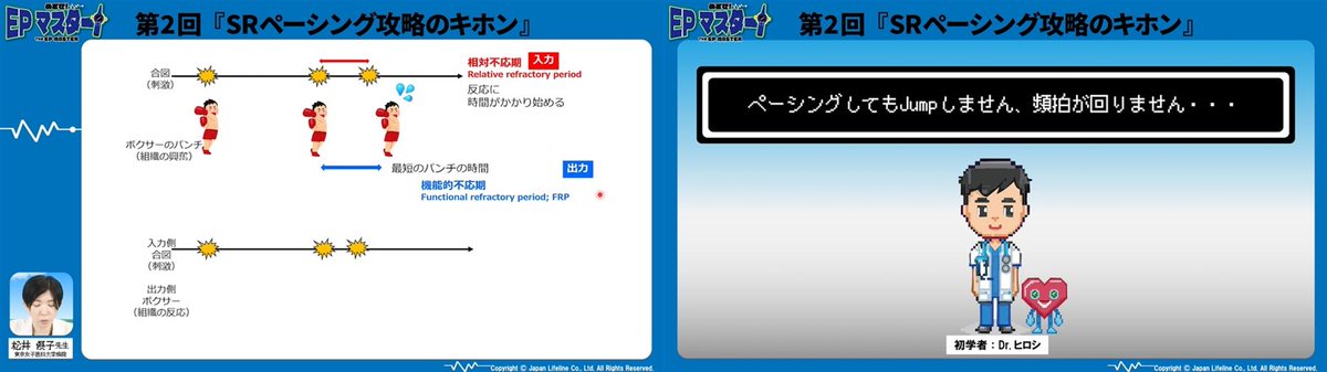 ⭐️めざせ！EPマスター⭐️
第2回「SR中ペーシングのキホン」

2回目の配信が開始になりました。今回は頻拍が誘発される前、baselineのEPSについて少しお話させて頂きました🫀⚡️
SVTのEPSを勉強中の方にとって、少しでもお手伝いになれば幸いです…！🙇‍♂️

配信はこちらです👉jllplus.jp/news/ep/202507…