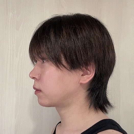 jin_623_'s tweet photo. 〜ダウンタイム11ヶ月経過〜

気づけばもうすぐ1年！
最初は毎日顔の変化ばっか気にしてたけど最近はいい意味で気にしなくなったし
むしろ今となっては鏡を見て落ち着けるようになってきて嬉しい

#id美容外科 #韓国整形 #骨切り
#両顎手術 #Vライン形成
#ルフォー #ssro https://t.co/nXTIRBYcqK