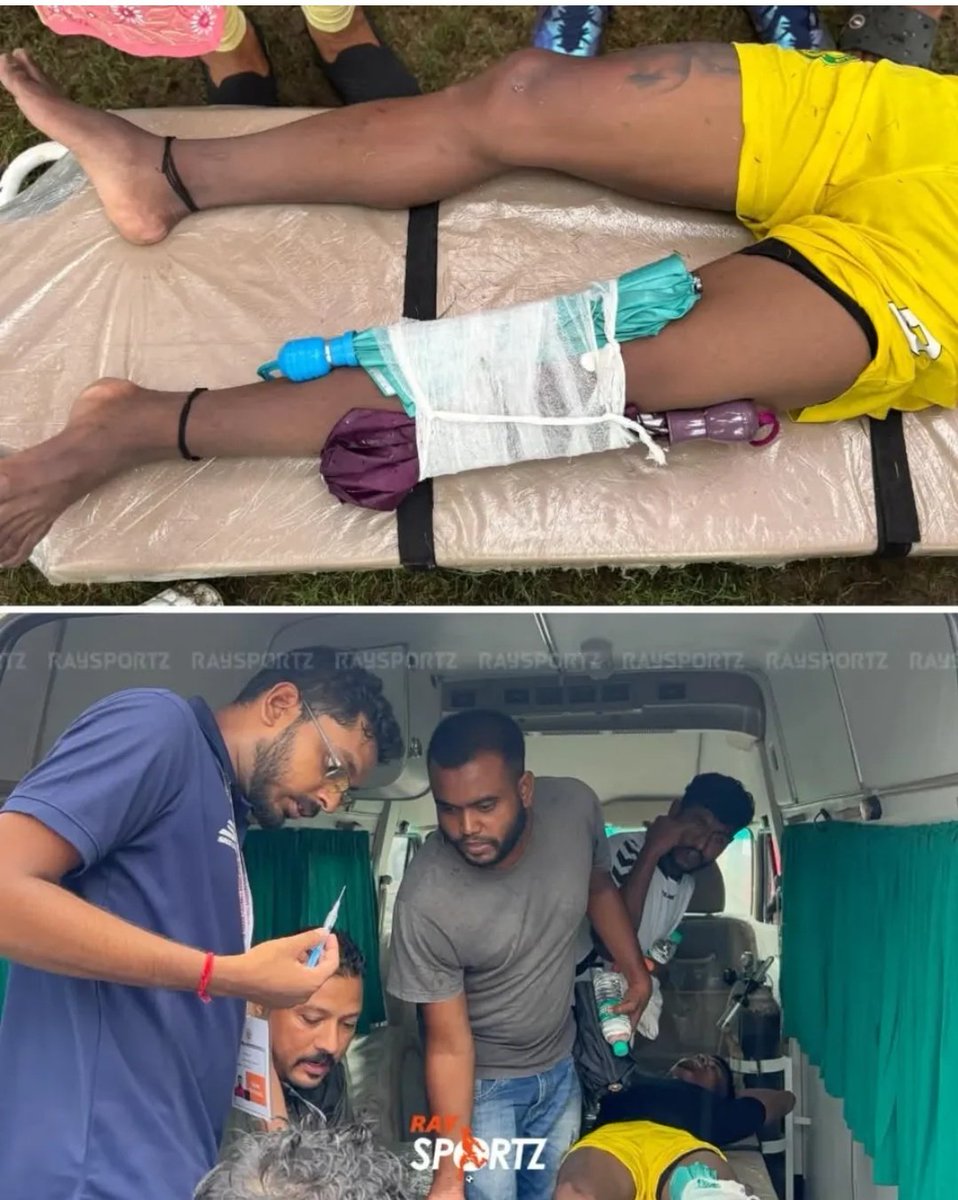 abdulrahmanmash's tweet photo. What the hell is this?! A serious leg injury and they have tied it up using an umbrella in the Calcutta Football League.

This is not just negligence, it’s downright dangerous.
Shameful that this is still happening in #IndianFootball

📸: @raysportzbangla https://t.co/Ak4yVlE7zC