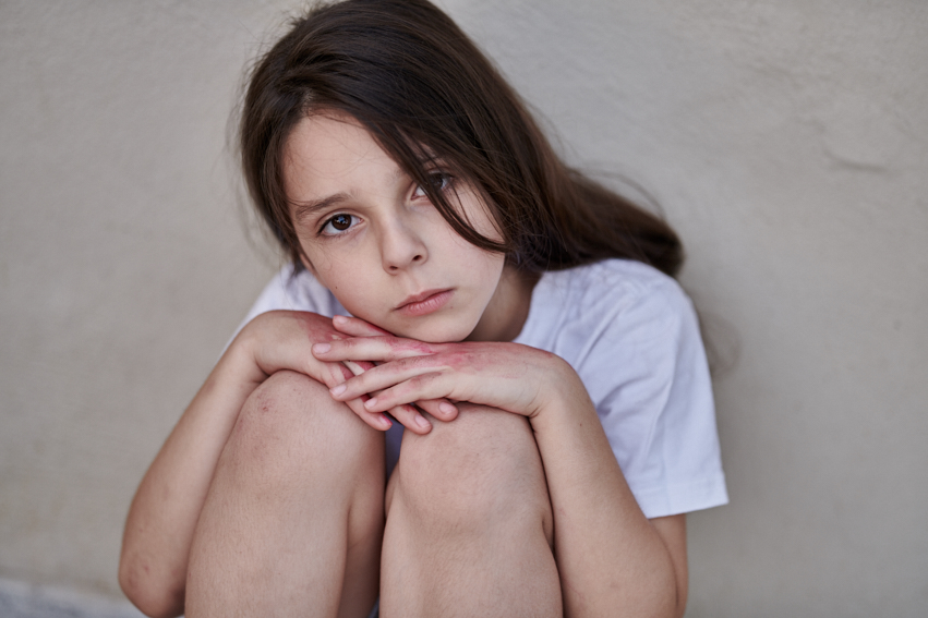 📊 Nearly half of young people in Montenegro (aged 14–19) believe that domestic violence is increasing.
Another 30% say it remains the same.
(Source: Ipsos for UNICEF, 2024 – nationally representative survey of youth aged 14–19)

🔴 This is not just a perception. It is a call to