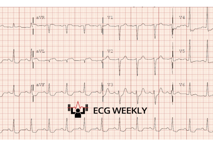 ECGWeekly tweet media