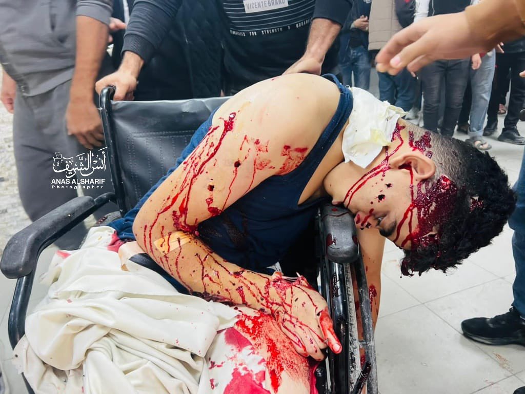 كما تشاهدون، لا حصانة لأحد؛ حتى المريض الجالس على كرسيه المتحرك تعرض لاستهداف...