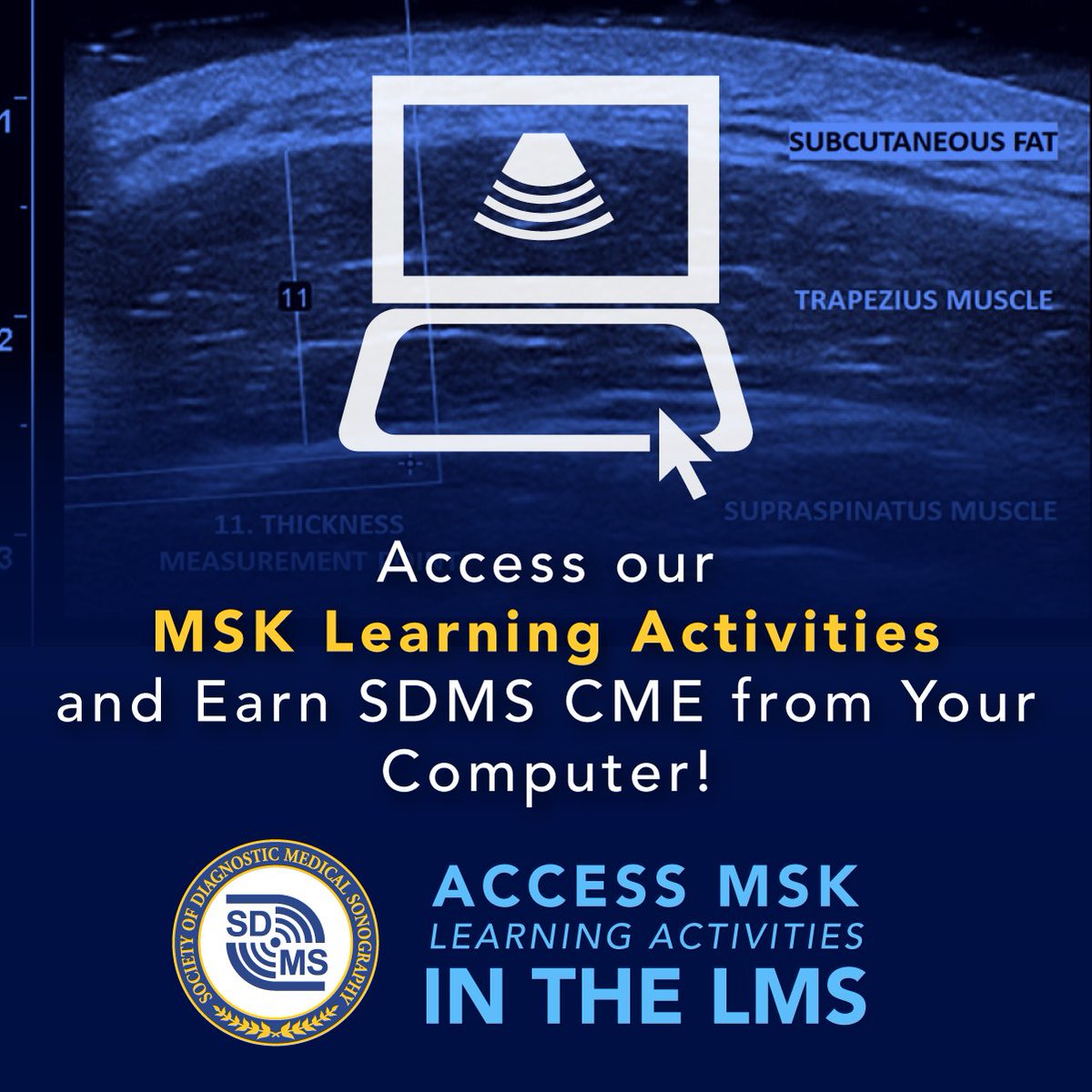 Access our #MSK learning activities and earn SDMS CME credits from your computer! bit.ly/4kpl6or
