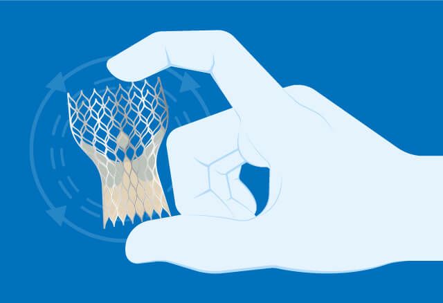 🔍 TAVI vs. cirugía en mujeres con estenosis aórtica severa
TAVI mostró mejores resultados al año
✅ Menor muerte, ACV y rehospitalización
📉 Menos FA
🛠️ Más marcapasos
🎯 Ambos grupos mejoraron calidad de vida
🩺 Por el Dr. Dr. Carlos Fava.
🔗 bit.ly/40G35u9