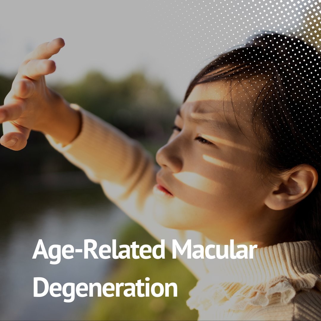 Prolonged exposure to sunlight increases the risk of developing Age-Related Macular Degeneration. Learn more about the symptoms and prevention methods—and how eSight Go can help: esighteyewear.com/vision-loss/ma…  

#eSight #eSightGo #AssistiveTechnology #LowVision #MacularDegeneration