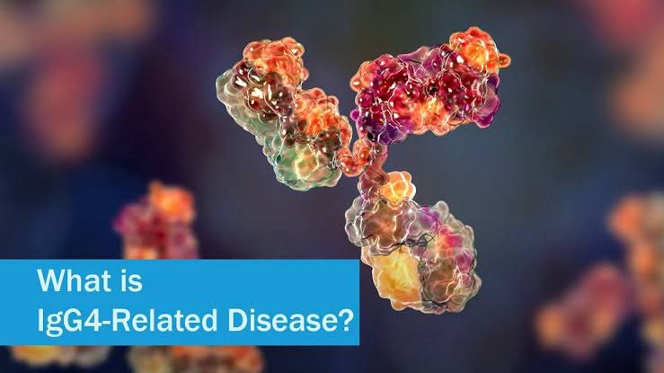 🧵 “10 Things Every Clinician Should Know About IgG4-Related Disease”

The great mimicker: swelling, fibrosis, and multi-organ dysfunction.
Here are 10 essentials to recognize IgG4-RD early 👇
#Rheumatology #MedTwitter #ClinicalPearls #IgG4 <a href="/IhabFathiSulima/">Dr Ihab Suliman</a> <a href="/DrAkhilX/">Dr. Akhil 🇮🇳</a>