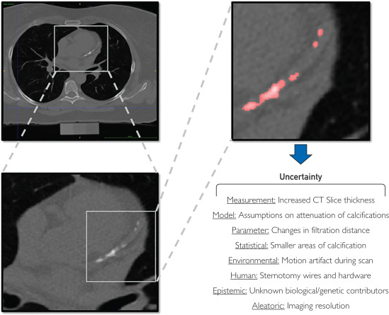 mcpdigital's tweet image. Topological uncertainty refers to ambiguities in spatial and structural characteristics of medical features, which can impact the interpretation of coronary plaques in medical imaging.
bit.ly/3TrLzpB