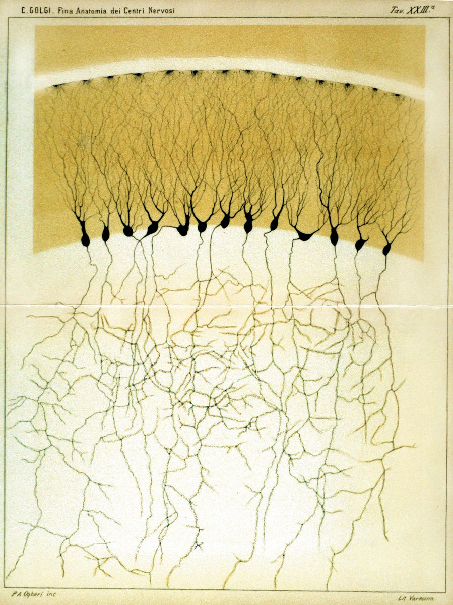 Camillo Golgi received the 1906 medicine prize for discovering nerve cells could be stained with silver nitrate. This enabled Golgi and other researchers to make detailed studies of our nervous system, such as the ones pictured. 

Learn more: bit.ly/2WxPIs3