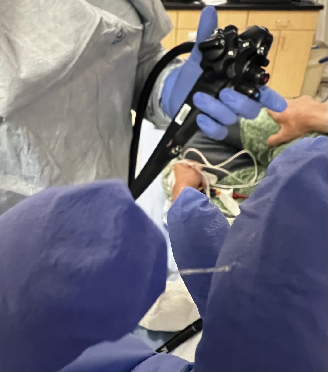 EUSandEndoscopy's tweet image. Nice example of a positive #StringSign for mucin from #EUS #FNA of an #IPMN in head of pancreas. This was done as a teaching demonstration for staff who never seen it before as was explaining IPMNs this am to them.