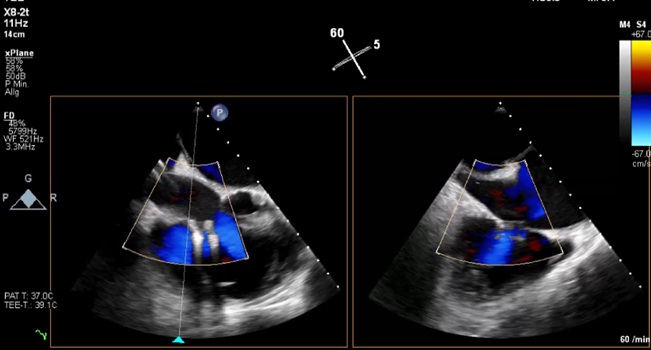 CMS Agrees to Reimburse Tricuspid TEER dlvr.it/TLnGY8