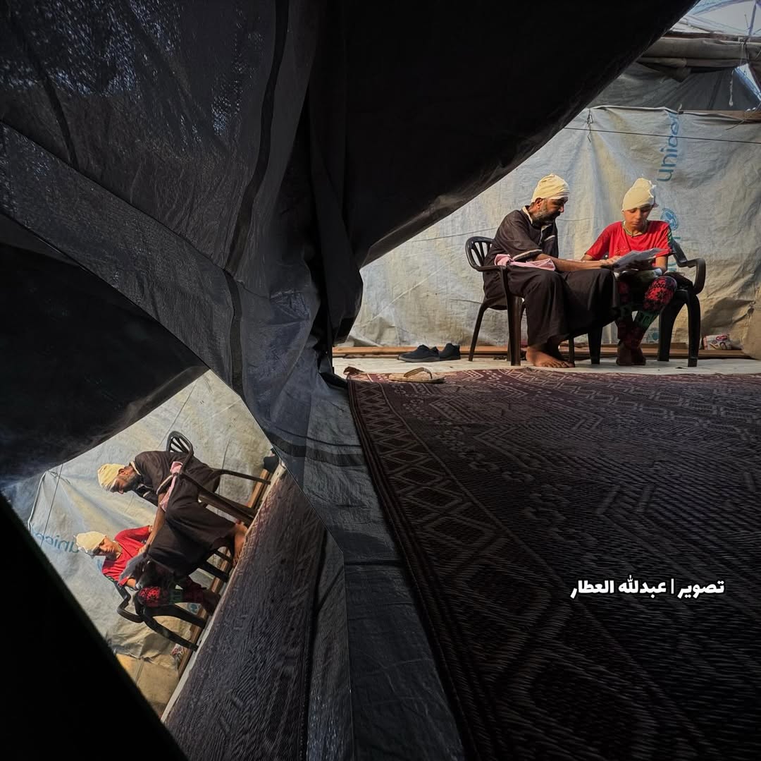 TIMES OF GAZA (@timesofgaza) on Twitter photo 12-year-old Hala Abu Dahleez was injured by an Israeli airstrike while playing near her displacement tent in Gaza.
The blast caused serious scalp injuries. She remains in Gaza, unable to access the medical care she needs due to the ongoing blockade. 12-year-old Hala Abu Dahleez was injured by an Israeli airstrike while playing near her displacement tent in Gaza.
The blast caused serious scalp injuries. She remains in Gaza, unable to access the medical care she needs due to the ongoing blockade.