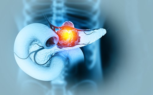 ASCOPost's tweet photo. 🧬 New data from @Snau_PhD suggest a modest association between alcohol intake 🍺 and increased #PancreaticCancer risk, even among nonsmokers.
🔍 Study led by Pietro Ferrari, MSc, PhD
📄 Details: https://t.co/5SbCI2xUzO
#Oncology #Epidemiology #CancerRisk #NewData https://t.co/1dmRkcmnw5