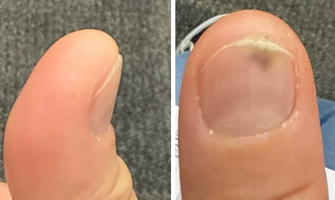 Emergency Medicine Case Challenge:
Thumb Pain
erpocketbooks.com/p9/