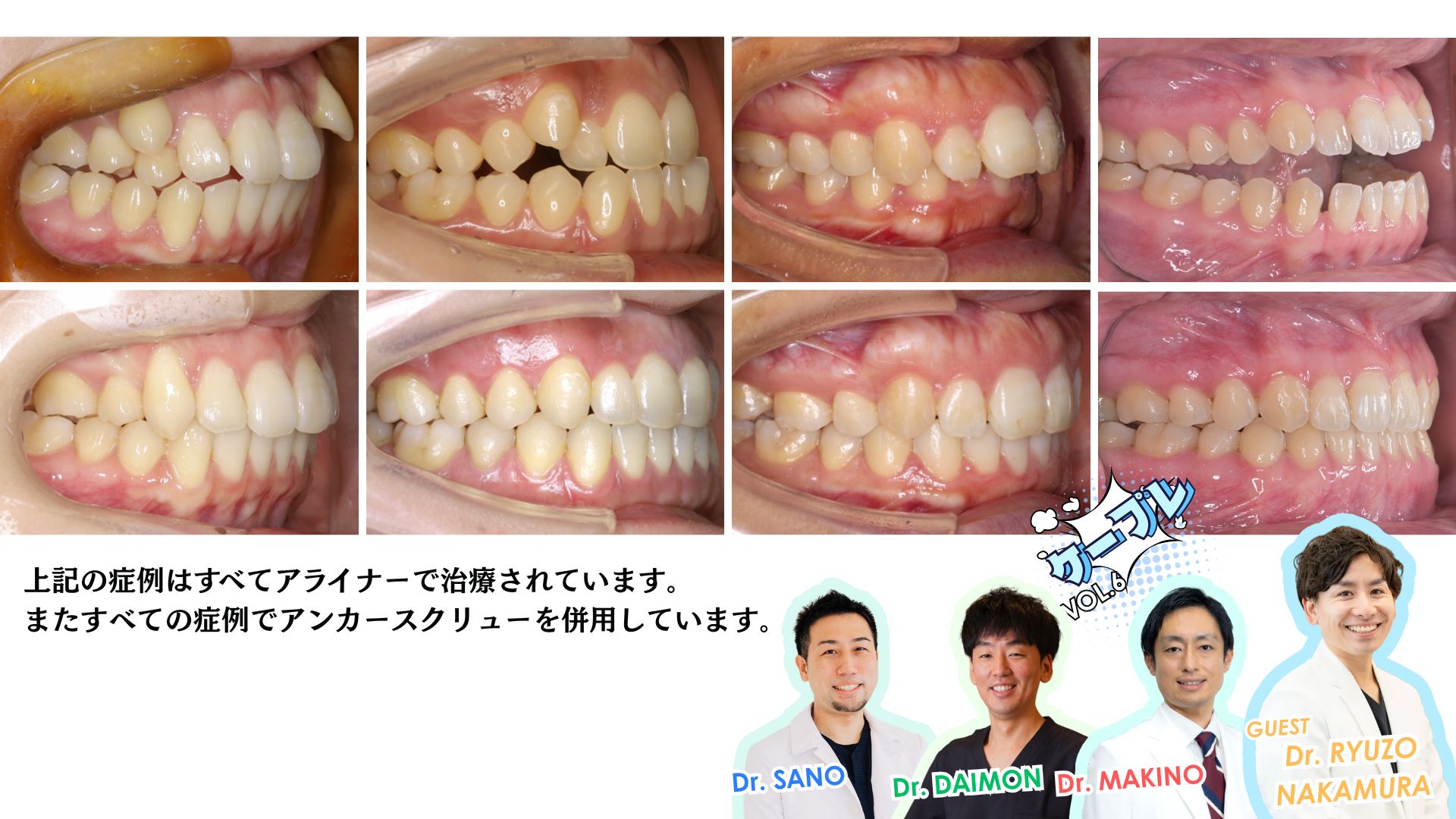 ドクターK 矯正医 (@orthodontistDrK) / X