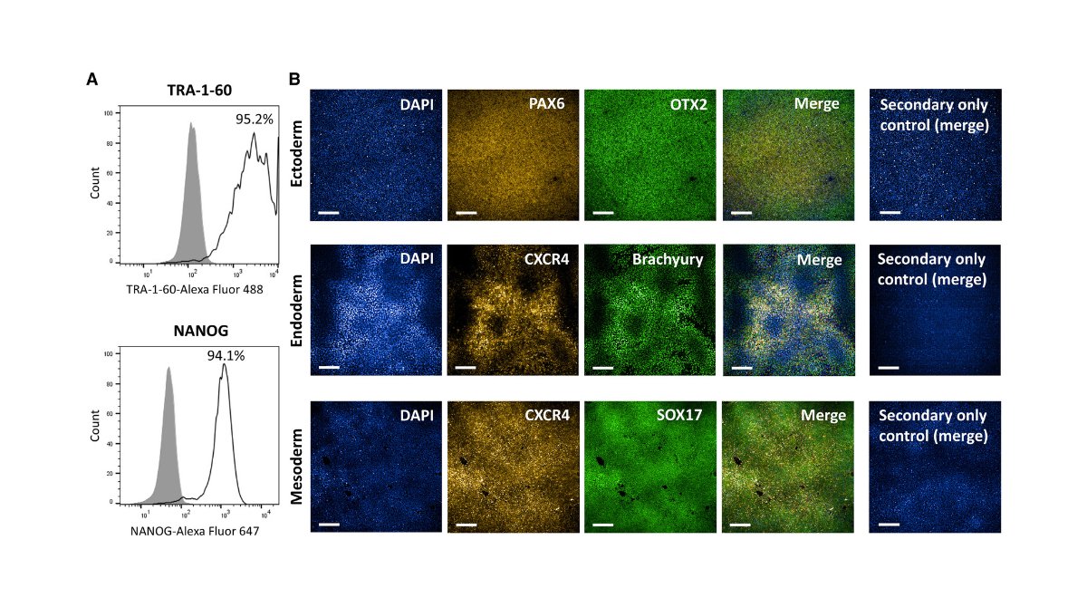stemcellreports's tweet image. Large-scale research resource models #Alzheimers disease with high and low polygenic risk in human iPSCs. 100+ lines from patients & controls, a powerful tool to study complex AD biology. ow.ly/TeMO50WlGMv
@UKDRI @UniofOxford @ISSCR @GairdnerAwards @SickKidsNews