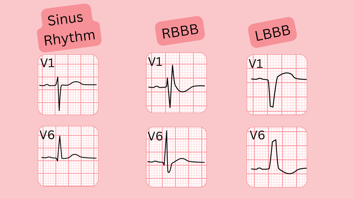 ECGsmart tweet media