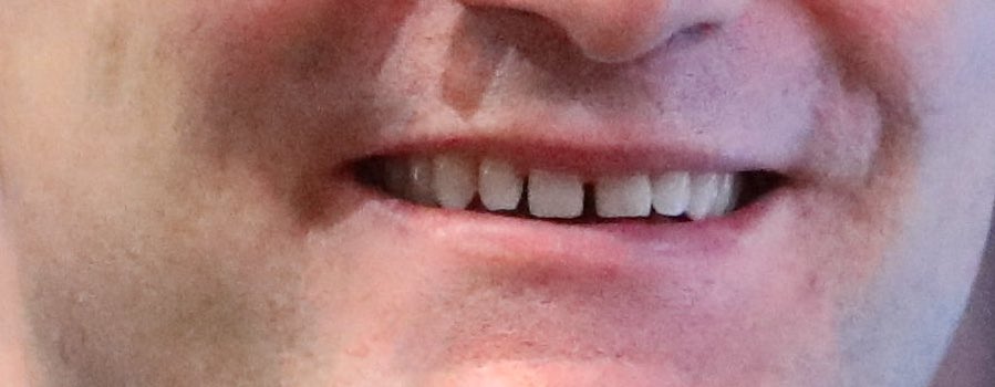 Hey <a href="/grok/">Grok</a>, wem gehört dieses Lächeln?