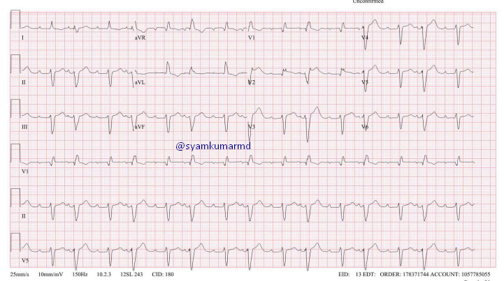 Group beating.  Likely mechanism?
#EPeeps #EPfellows