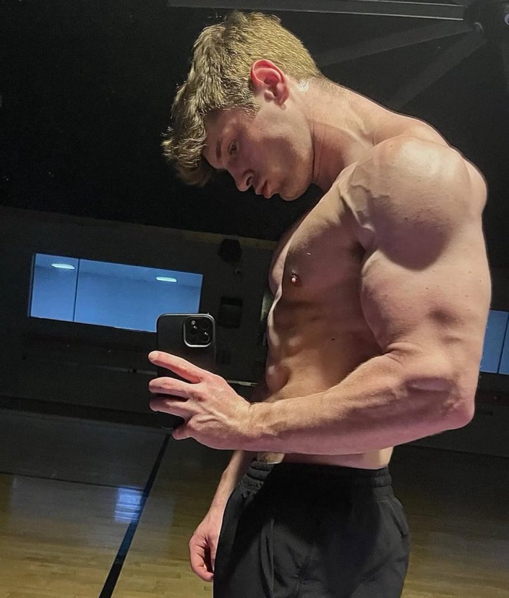 How much would you pay for a black eye?